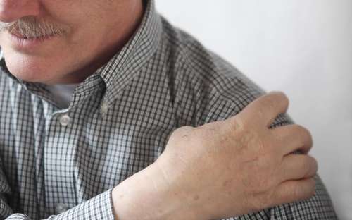 Physiotherapy for Frozen Shoulder or Adhesive Capsulitis